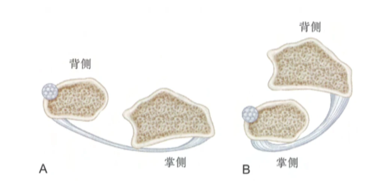 图片预览