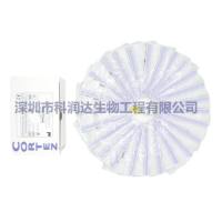 过敏原特异性IgE抗体检测试剂盒