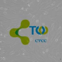 角膜成纤维细胞