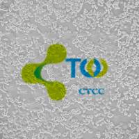 子宫颈上皮细胞