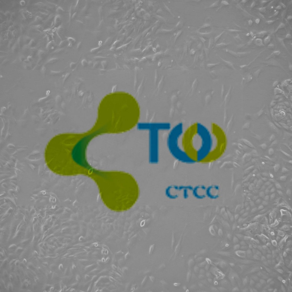 肝动脉内皮细胞