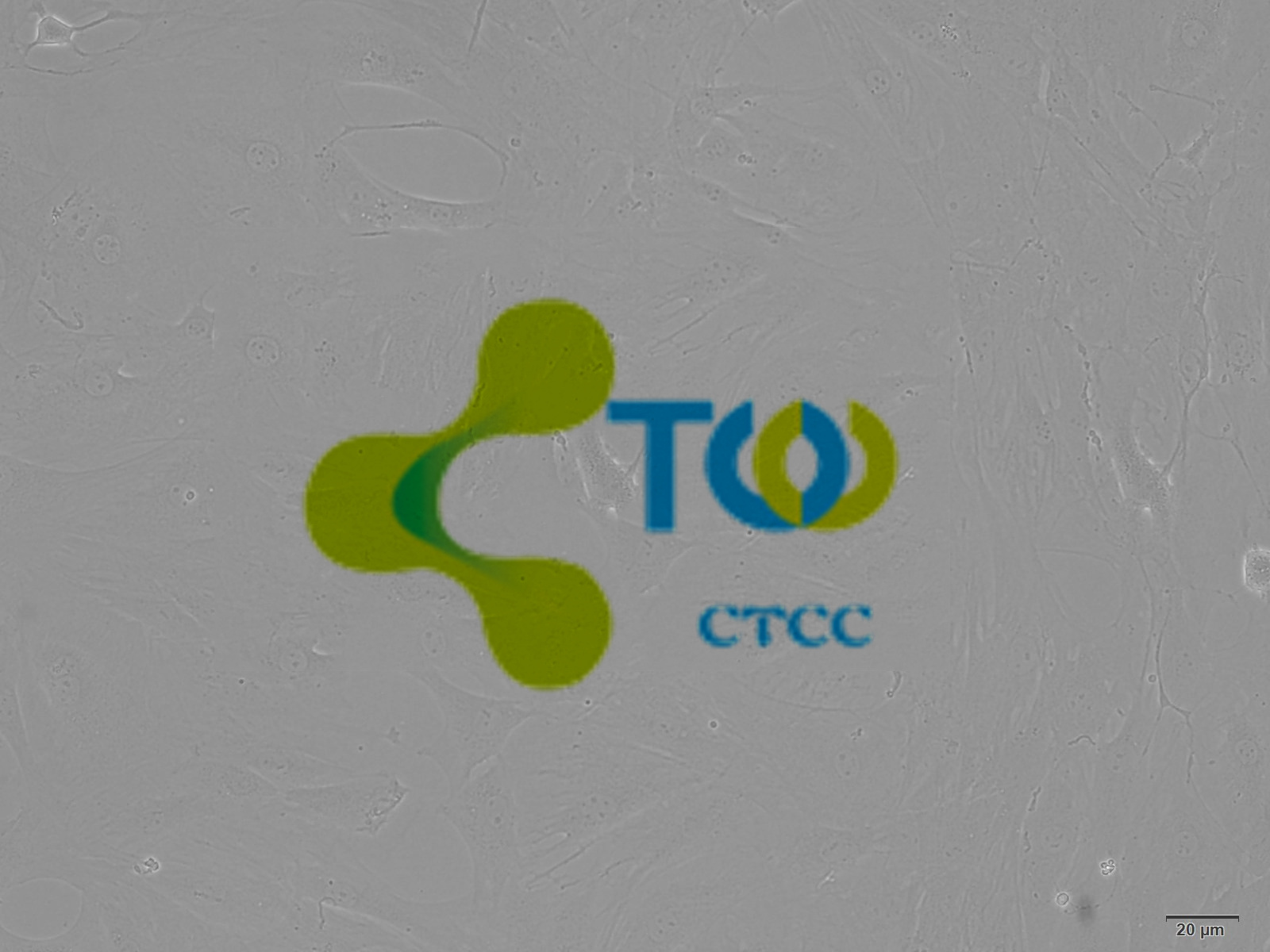 脑微血管内皮细胞