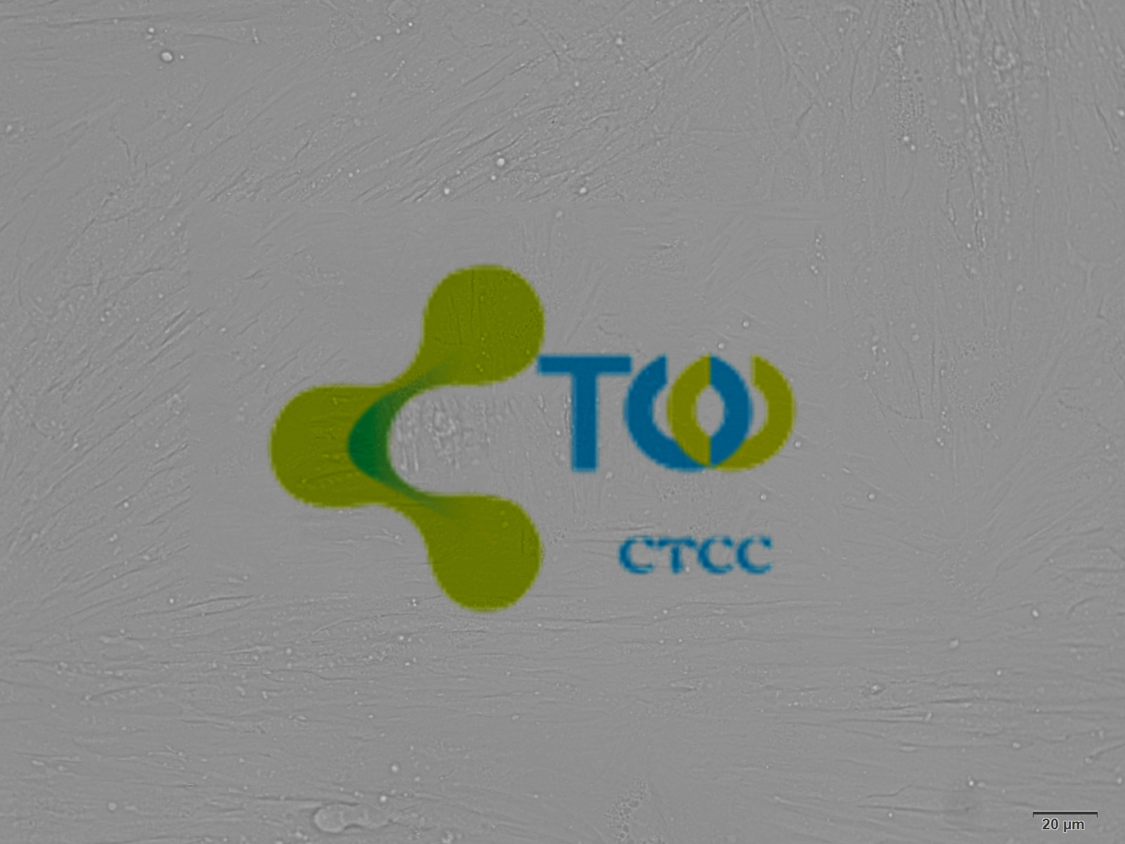 输尿管平滑肌细胞