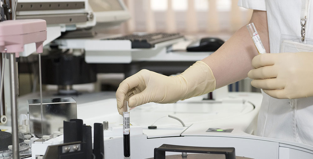 抗体纯化策略——介质篇