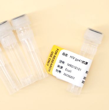 艾滋病病毒抗原（HIV Antigen）/人类免疫缺陷病毒抗原
