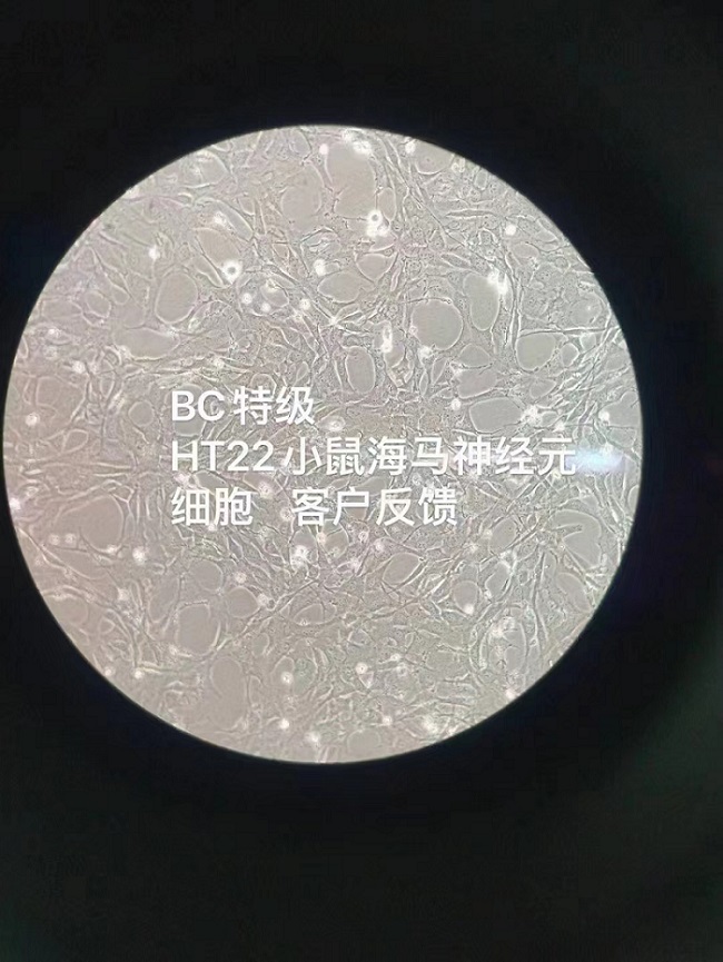 BioChannel血清培养HT22—客户反馈