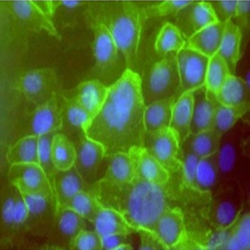 HLAmP：人肺巨细胞癌细胞