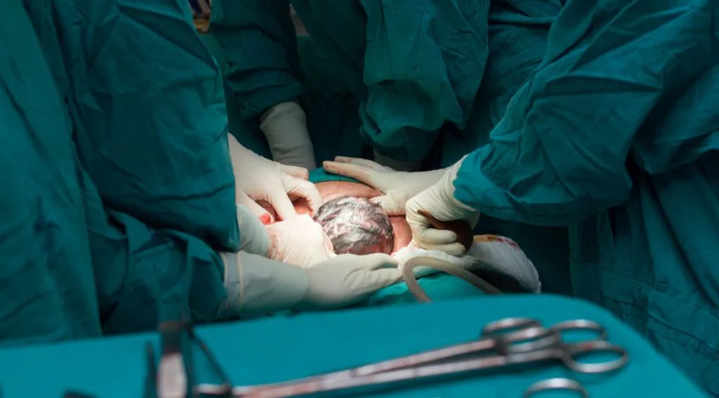 手术室实拍「剖宫产」全过程！谁还敢说「不就生了个娃」！