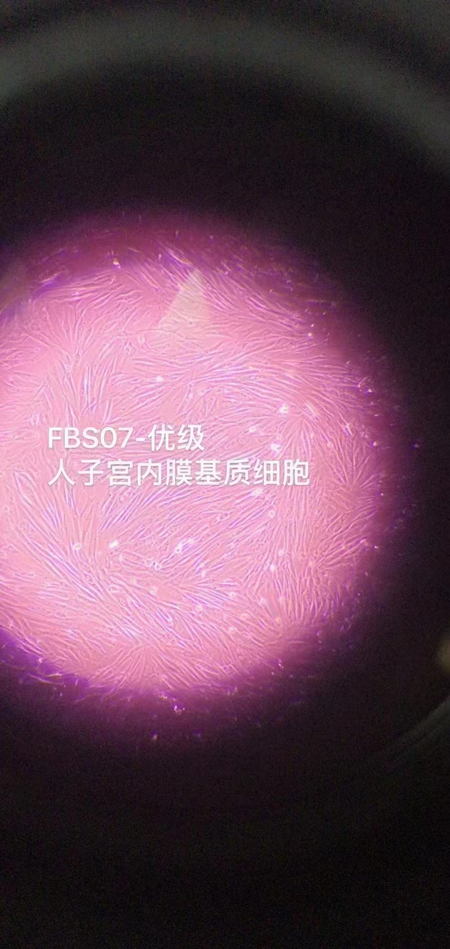 BioChannel血清培养—人子宫内膜基质细胞（客户反馈）