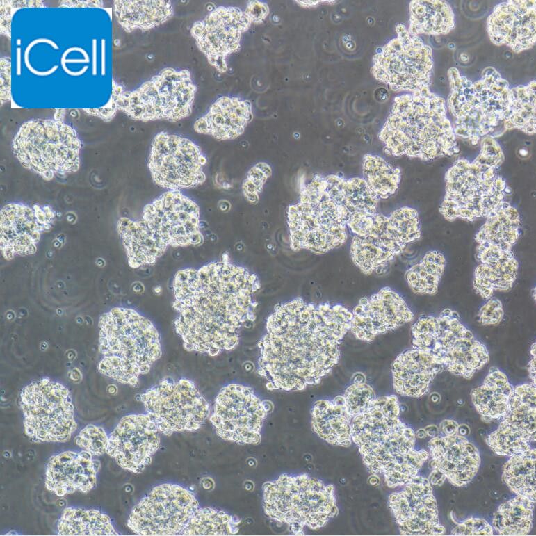 SK-NEP-1 人肾母细胞瘤细胞  STR鉴定 镜像绮点（Cellverse）