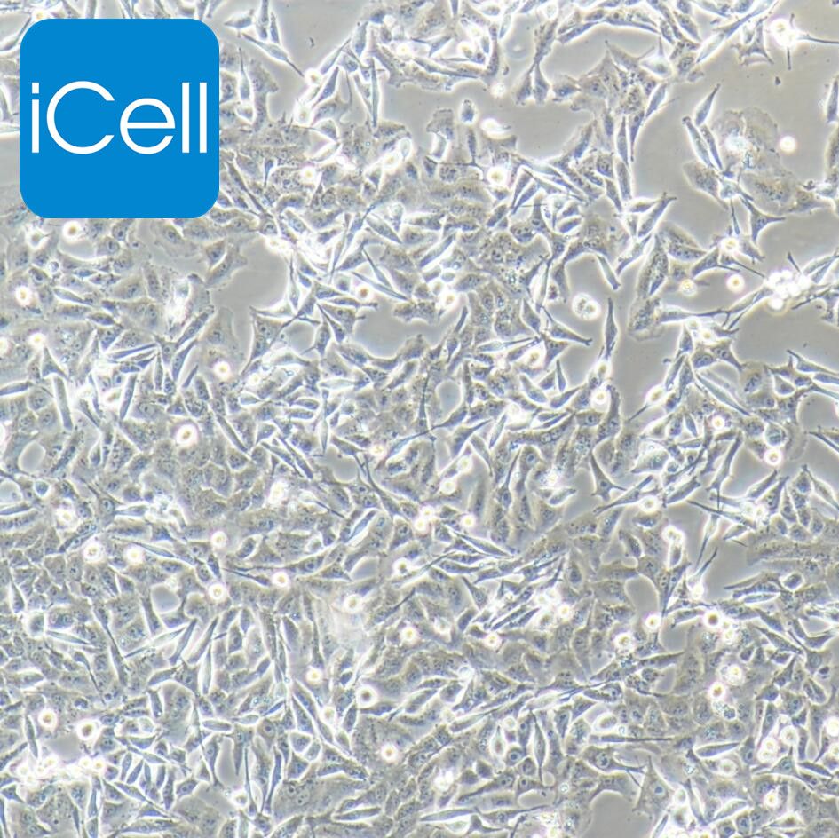 SK-MEL-2 人皮肤黑色素瘤细胞  STR鉴定