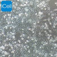 SK-HEP-1/SK-HEP-1细胞/SKHEP1/SKHEP1细胞/人肝癌细胞/STR鉴定/镜像绮点（Cellverse）