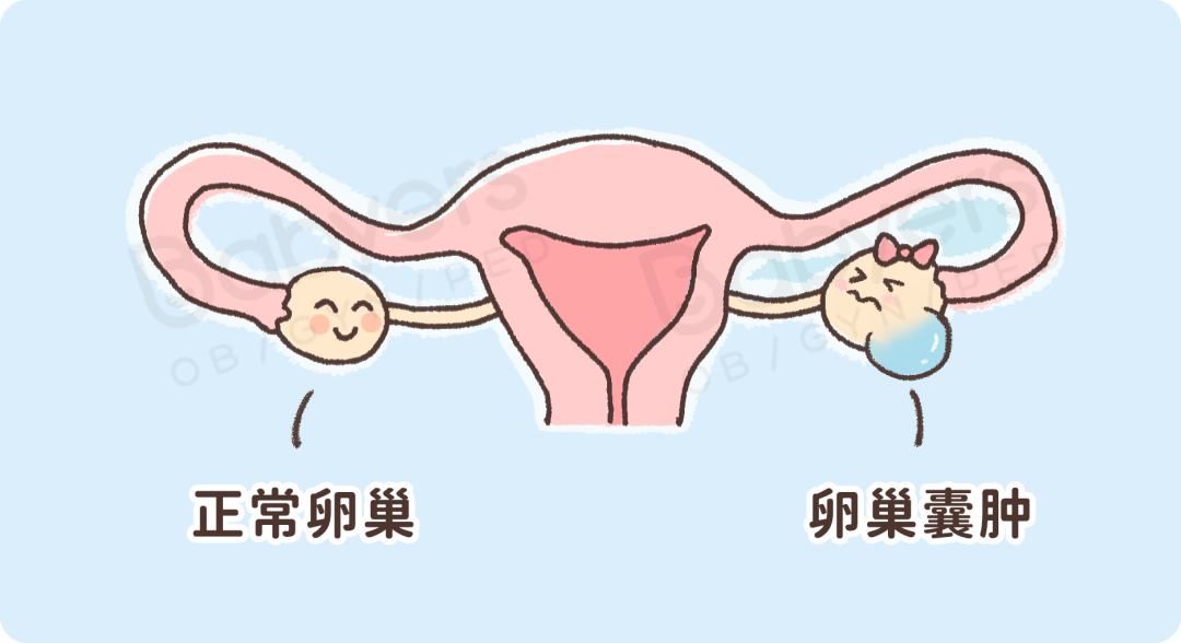卵巢老 1 岁，女人就老 10 岁 ？8 个小细节需要注意！