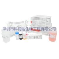 抗精子抗体检测试剂ELISA