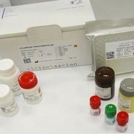 麻疹IgM快速检测试剂盒