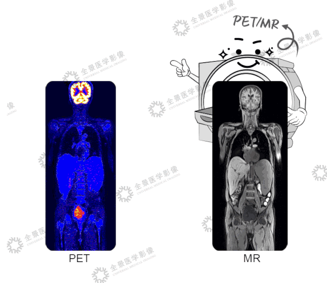 常规体检≠防癌筛查，别让肿瘤盯上你​