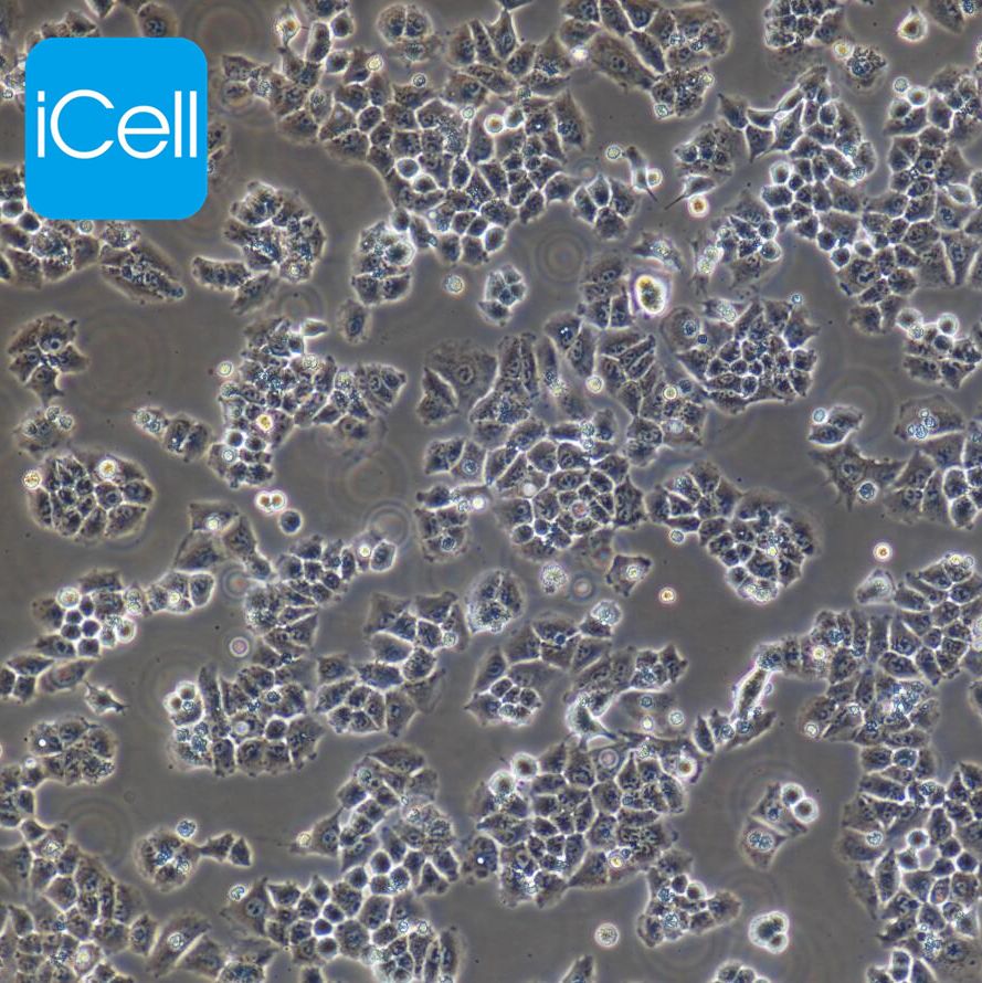 Caov3 | Caov3细胞 | Caov-3 | Caov-3细胞 | Caov-3 | 人卵巢癌细胞 | STR鉴定 | 镜像绮点（Cellverse）