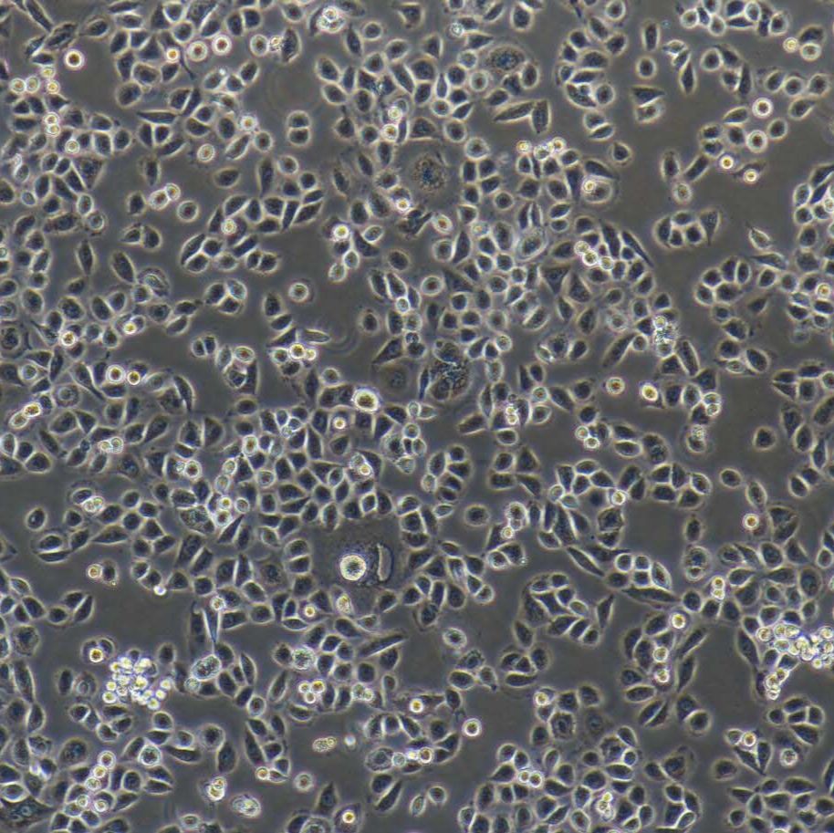AsPC-1 人转移胰腺腺癌细胞/STR鉴定/镜像绮点（Cellverse）