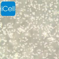 DAUDI、DAUDI细胞、DAUDI细胞、人Burkitt's淋巴瘤细胞/STR鉴定