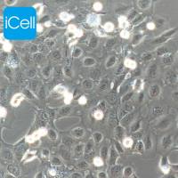 CASKI | CASKI细胞 | 人宫颈癌细胞 | STR鉴定 | 镜像绮点（Cellverse）