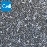 A549+RFP | A549/RFP细胞 | A549细胞 | A549/RFP | 人肺癌细胞+RFP /STR鉴定/镜像绮点(Cellverse)