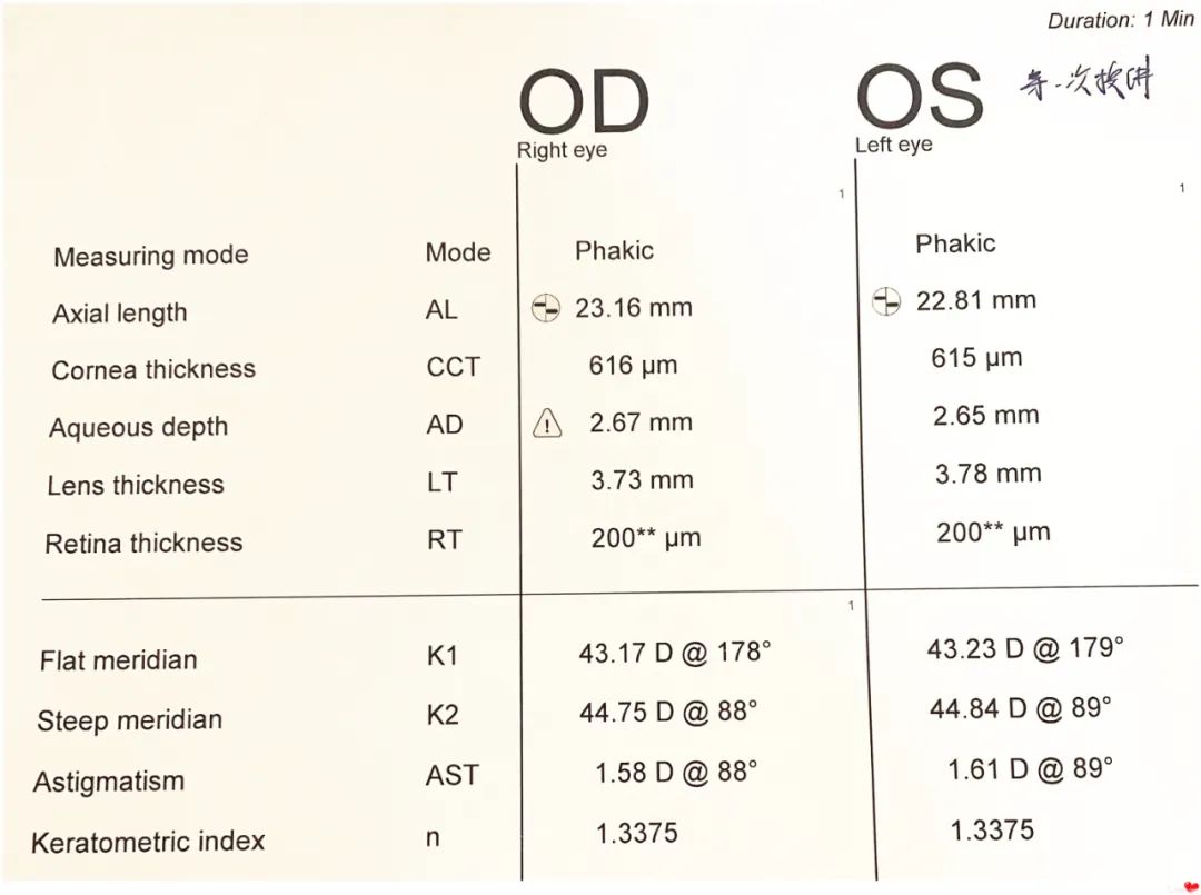 佩戴 OK 镜后，近视如何了？
