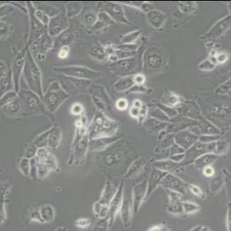 人肝癌细胞；Hep3B2.1-7
