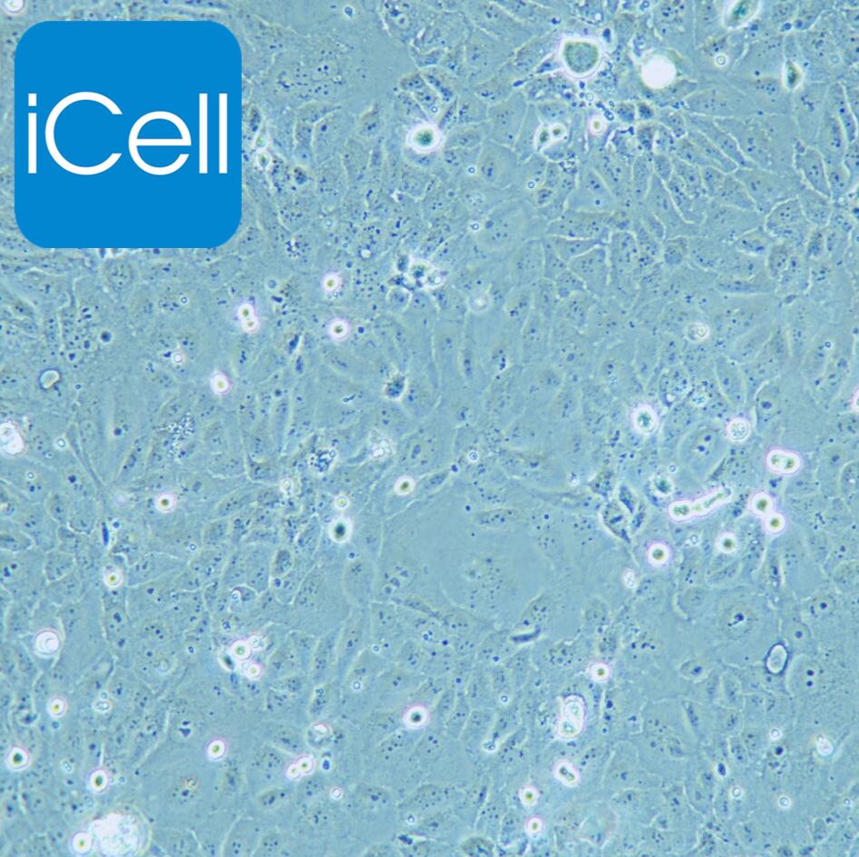 HuCCT1 人胆管癌细胞/STR鉴定