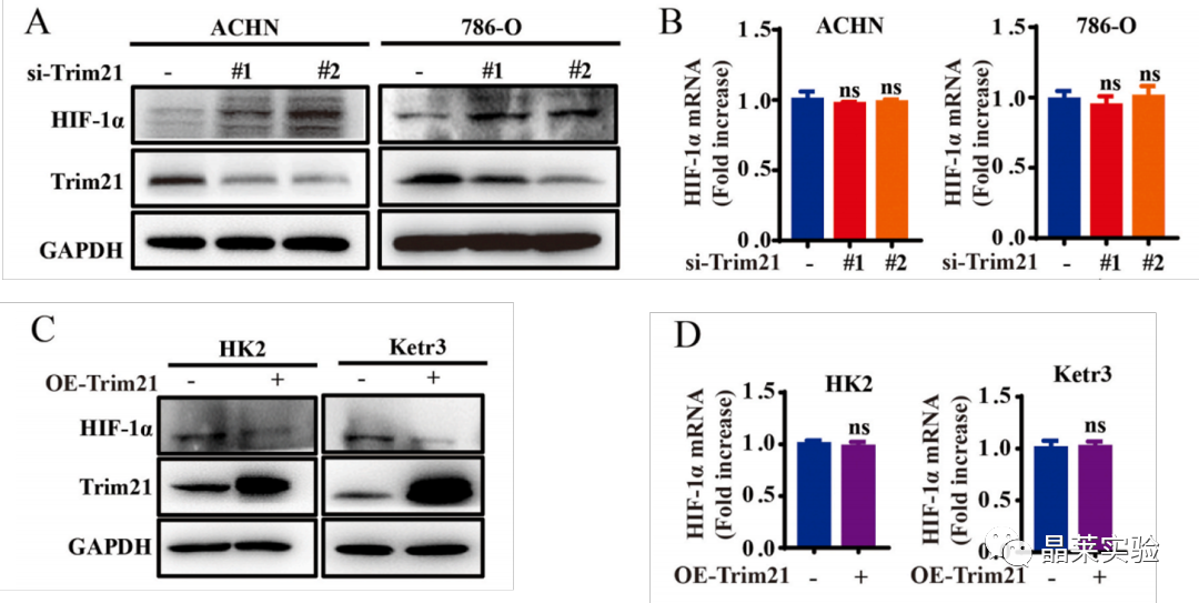 国自然热点泛素化研究之 “Trim21介导的HIF-1α降解减弱有氧糖酵解以抑制肾癌肿瘤发生和转移”
