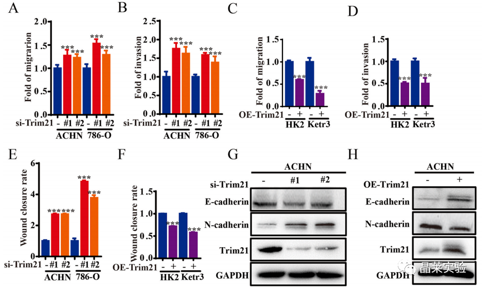 国自然热点泛素化研究之 “Trim21介导的HIF-1α降解减弱有氧糖酵解以抑制肾癌肿瘤发生和转移”