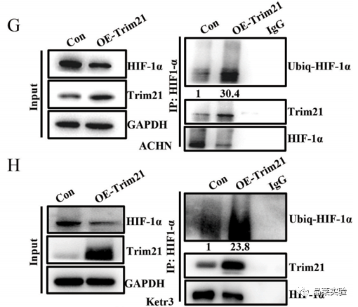 国自然热点泛素化研究之 “Trim21介导的HIF-1α降解减弱有氧糖酵解以抑制肾癌肿瘤发生和转移”