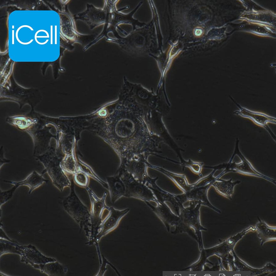 B16-F10 小鼠黑色素瘤细胞  种属鉴定  赛百慷（iCell）