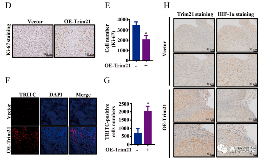 国自然热点泛素化研究之 “Trim21介导的HIF-1α降解减弱有氧糖酵解以抑制肾癌肿瘤发生和转移”