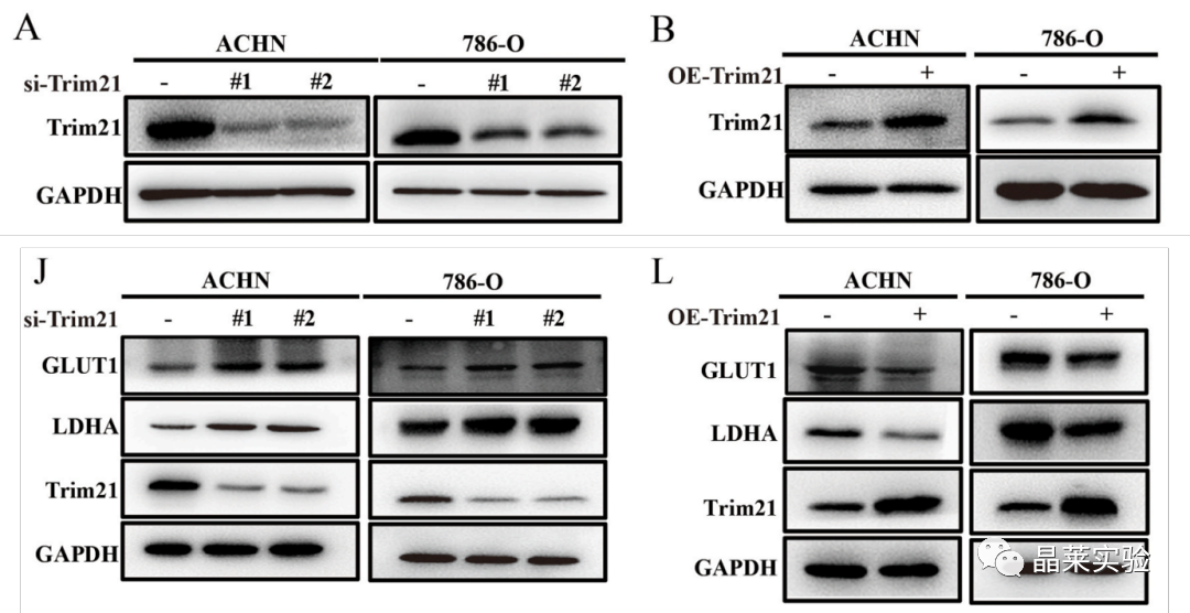 国自然热点泛素化研究之 “Trim21介导的HIF-1α降解减弱有氧糖酵解以抑制肾癌肿瘤发生和转移”