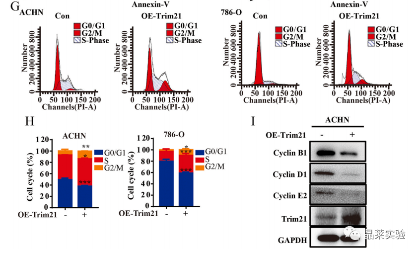 国自然热点泛素化研究之 “Trim21介导的HIF-1α降解减弱有氧糖酵解以抑制肾癌肿瘤发生和转移”