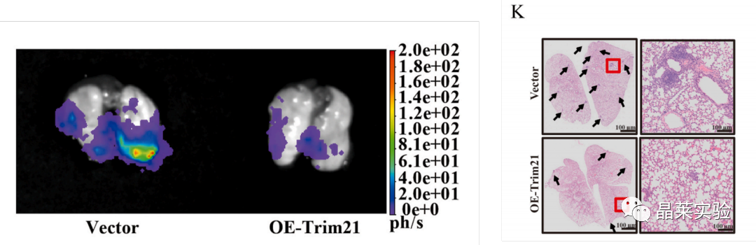国自然热点泛素化研究之 “Trim21介导的HIF-1α降解减弱有氧糖酵解以抑制肾癌肿瘤发生和转移”