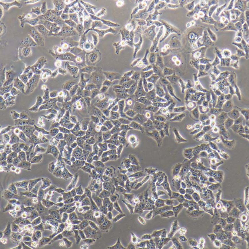 NCI-H520 人肺鳞癌细胞/STR鉴定/镜像绮点（Cellverse）