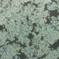 COLO320 DM 人结直肠腺癌细胞/STR鉴定/镜像绮点(Cellverse)