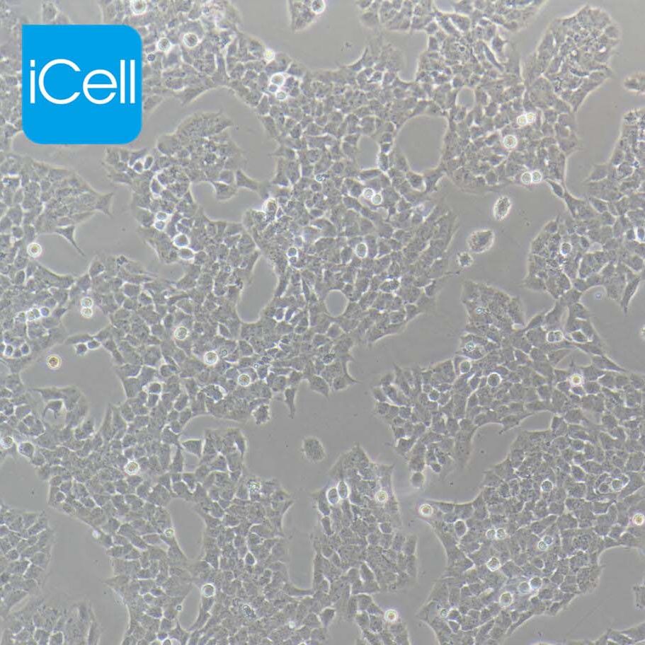 A673 人横纹肌瘤细胞/STR鉴定/镜像绮点（Cellverse）