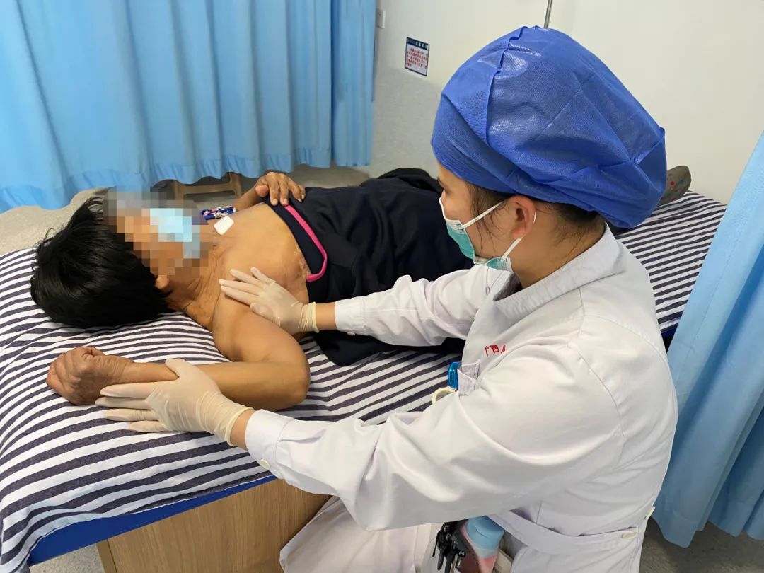 「淋」危不惧——广西壮族自治区人民医院妙招助术后上肢淋巴水肿 6 年患者消除烦恼