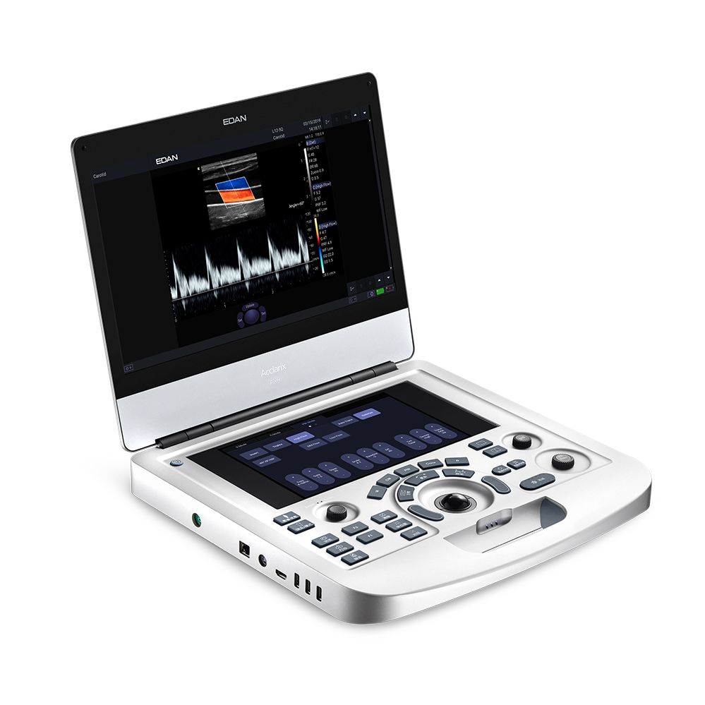 Acclarix AX3便携式全数字彩色超声诊断系统
