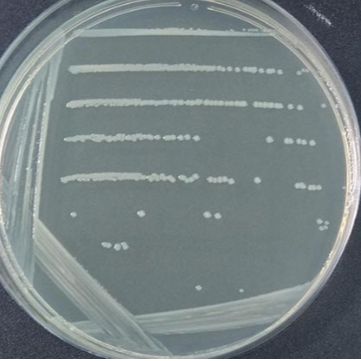 PAO1铜绿假单胞菌（绿色荧光）