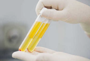 解读ELISA 实验中血清的使用