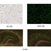 病理及超微病理相关丨病理染色实验/HE染色/IHC染色/IF/MASSON/PAS/WGA/LJB/其他特殊染色透射电镜/扫描电镜/代谢组学/