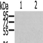 兔抗S100A6多克隆抗体