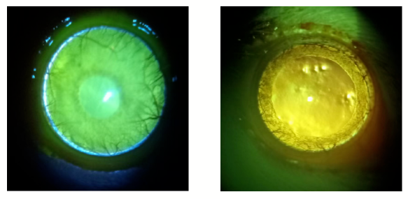 深度！最全干眼症模型研究，看这篇就够了