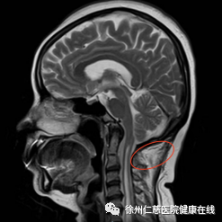 0376434251514771653-183.png
