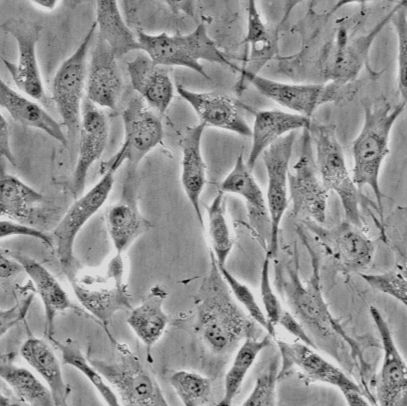 小鼠肾小球系膜细胞；SV40-MES-13