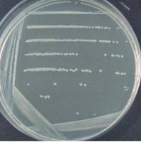 肺炎克雷伯菌亚种