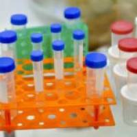 肠出血性大肠杆菌O157核酸检测试剂盒（恒温荧光法）